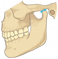 ３つのことが実際にお口の中でも起こっている可能性がある